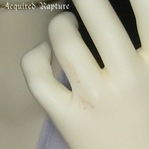 his wound